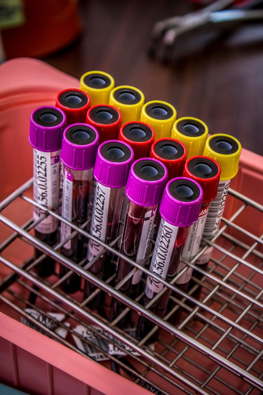 Blutröhrchen im Labor, Vorbereitung für Vitamin-B12-Bluttest mit HoloTC und Methylmalonsäure