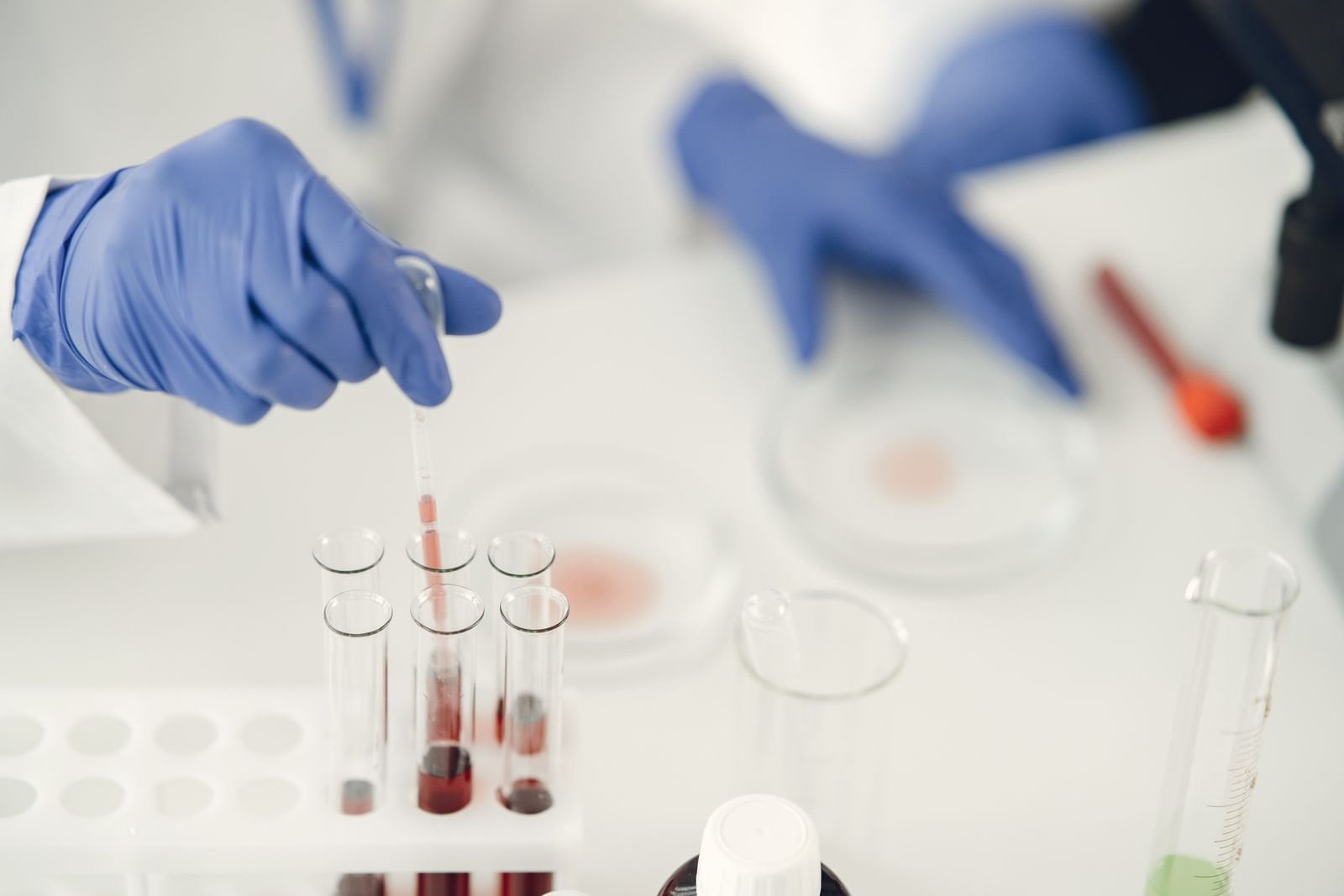 Gloved hands pipetting a blood sample into test tubes in a laboratory