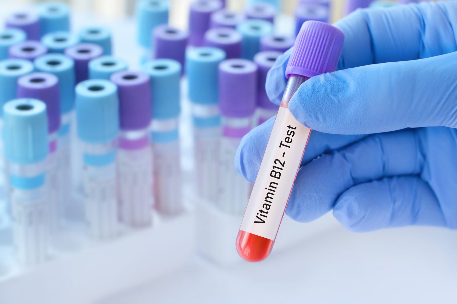 Behandschuhte Hand hält ein Blutröhrchen mit der Aufschrift Vitamin B12 Test vor Laborröhrchen